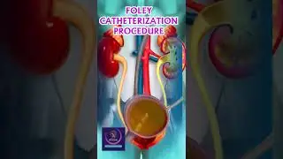 Foley Catheterization Animation - Urine Drainage Process