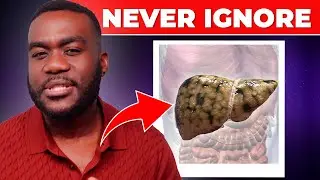 10 signs that could indicate Fatty Liver Disease
