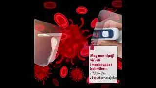 Monkeypox (maymun çiçeği) virüsünden korunmak için nelere dikkat edilmelidir?
