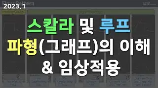 스칼라 및 루프 파형의 이해 및 임상적용 (Scalar, Loop, Waveform, Decelerating, Constant flow)