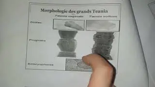 Taena saginata & taenia solium@