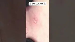 Huge, OMG?