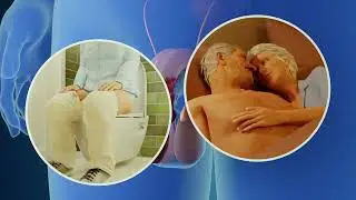 Penile Cancer Overview of Treatment