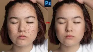 Advanced High End Face Retouching in Photoshop | Skin Retouching 2024