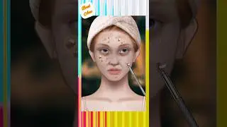 #pimplepopper#transformation makeup from ugly to pretty #asmr #animation #makeup#shortsvideo