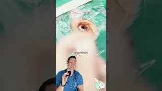 Soy sauce in the eye?!! - Doctor Reacts