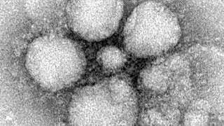 Le coronavirus MERS se propage : premier cas aux USA