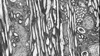 Keyframe of  Mouse Brain