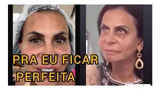 Gretchen está se sentindo maravilhosa com o tratamento de olheiras que fez