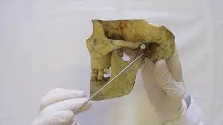 Височно нижнечелюстной сустав