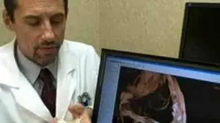 Utilizing Cad/cam technology in placing dental implants