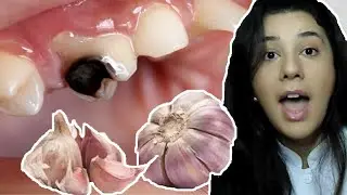 How to relieve toothache! Discover 7 easy tips to do at HOME!