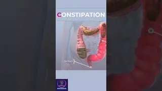 Constipation 