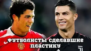 6 ЗНАМЕНИТЫХ ФУТБОЛИСТОВ, СДЕЛАВШИХ ПЛАСТИКУ!