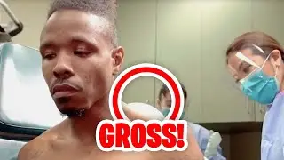 INSANELY DISGUSTING Moments From Dr. Pimple Popper!