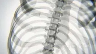 X-ray Body in Motion - Yoga