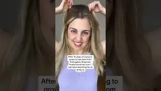 The ultimate hair loss journey ❤️ 