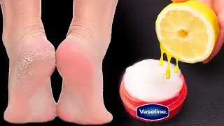 Mix petroleum jelly with lemon and you will be shocked! If only I had known about it sooner