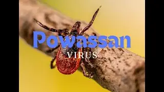 Powassan virus disease reported in Sharon, Massachusetts