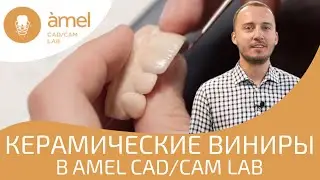 Изготовление керамических винир в Bauers CAD / CAM Lab