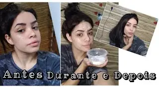 COMO CLAREAR AS MANCHAS EM CASA , / Arroz e leite para uniformizar a pele !