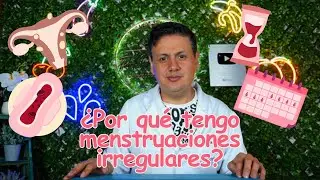 Por qué tengo irregularidades en la regla?