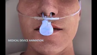 Medical Device Animation by Arcreative Media (3D Medical Device Animation)