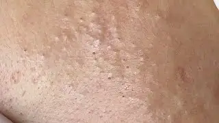 Satisfying Relaxing with Sac Dep Spa 