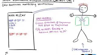 Assist Control Ventilation