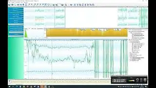 Ветеринарный 2 - обработка QRS