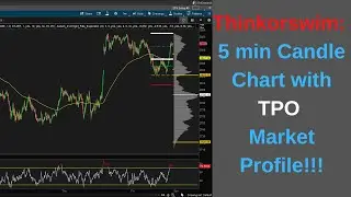 Day Trading Candlestick Chart With TPO Market Profile...