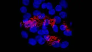 Primary cells isolated from nasal epithelium