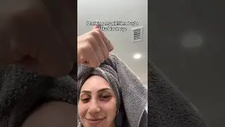 Pranking my girlfriend with a fake black eye 
