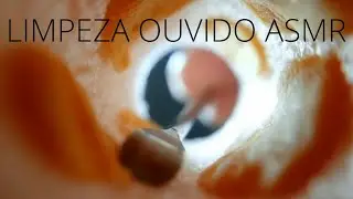 ASMR LIMPEZA OUVIDO REALISTA 👂