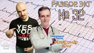Разбор ЭКГ № 32
