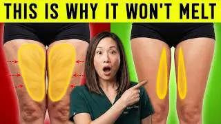 10 MINUTES A DAY — INNER THIGH FAT FINALLY MELTS OFF