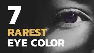 7 RAREST EYE COLOR