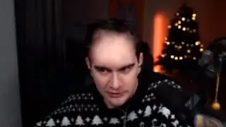 облысение 89%
