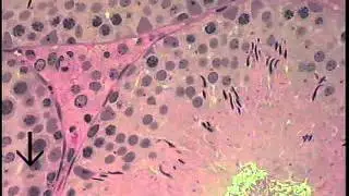 Testis Anatomy 2203