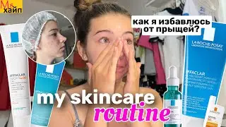 MY SKINCARE ROUTINE🧴как я избавляюсь от прыщей?! LAROCHE POSAY