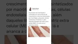 Como ocorre a Cicatrização #shorts