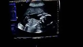 More inside sally's belly