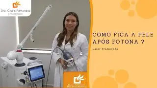 Como fica a pele após o Fotona? Laser no modo fracionado