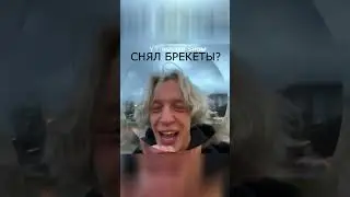 СНЯЛИ БРЕКЕТЫ🎉 РЕАКЦИЯ | приколы с хазяевами 