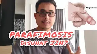 CARA PENANGANAN PARAFIMOSIS DIRUMAH / DISUNAT JIN / KULUP PENIS TIDAK BISA KEMBALI SEPERTI SEMULA