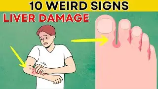 WARNING! 10 Weird Signs Of LIVER DAMAGE that Your Body is Asking for Help | Daily Joy