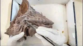 Naso pharynx