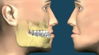 Хирургия и ортодонтия в Сумах