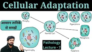 Cellular Adaptation - Atrophy, Hypertrophy, Hyperplasia, Metaplasia & Dysplasia || Pathology Lecture