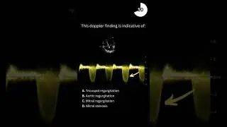 Echocardiography board practice question #11